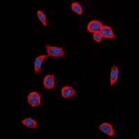 Anti-VEGFR2 (Phospho-Y1214) Antibody
