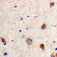 Anti-PKC theta (Phospho-S695) Antibody