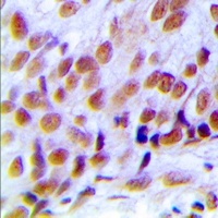 Anti-hNRNP C (Phospho-S260) Antibody