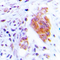 CDC37 (Phospho-S13) Rabbit Polyclonal Antibody