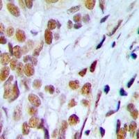 Anti-Lupus La (Phospho-S366) Antibody