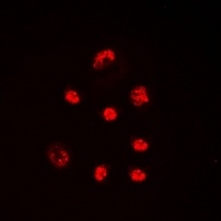 Anti-Lupus La (Phospho-S366) Antibody