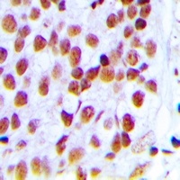 Ku80 Antibody