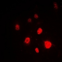 Ku80 Antibody