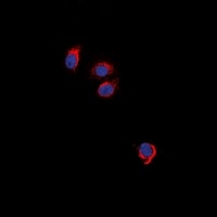 Anti-EPO Receptor Antibody