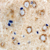 Anti-GLUR4 Antibody
