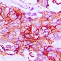 IFNGR1 antibody