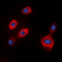 Anti-TPH1 Antibody