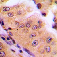 MGCRACGAP Antibody