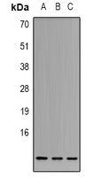 Cystatin A Rabbit Polyclonal Antibody