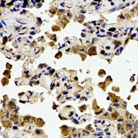 Cystatin A Rabbit Polyclonal Antibody
