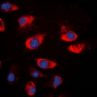 Cystatin A antibody