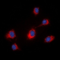 Anti-MID1 Antibody