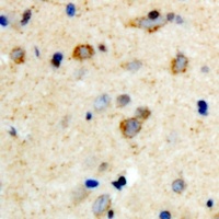 Anti-mPR gamma Antibody