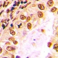 Anti-Nibrin Antibody