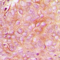 Anti-STMN1 (Phospho-S16) Antibody