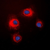 STMN1 (phospho-S16) antibody