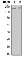 BRCA1 (Phospho-S1423) Antibody