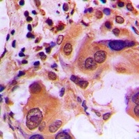 BRCA1 (phospho-S1423) antibody
