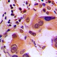 Anti-BRCA1 (Phospho-S1423) Antibody