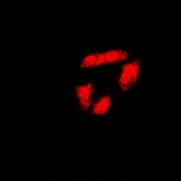 Anti-BRCA1 (Phospho-S1423) Antibody