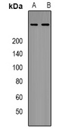 p300 Rabbit Polyclonal Antibody