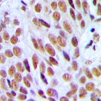 Anti-p300 Antibody