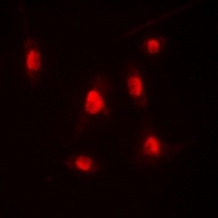 Anti-p300 Antibody
