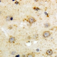 Anti-NTR1 Antibody
