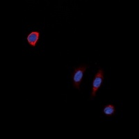 Anti-NTR1 Antibody