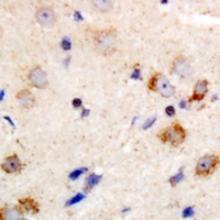 Anti-PKC theta Antibody