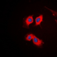 Anti-PKC theta Antibody