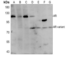 Androgen Receptor Rabbit Polyclonal Antibody