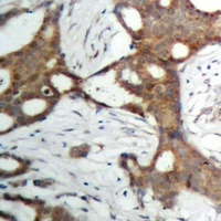 Androgen Receptor Rabbit Polyclonal Antibody