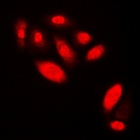 Androgen Receptor Rabbit Polyclonal Antibody
