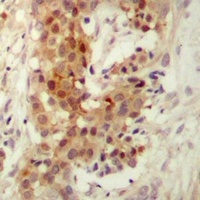 Anti-PKC iota/zeta Antibody