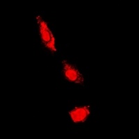 Anti-PKC iota/zeta Antibody