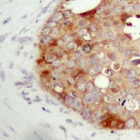 Anti-FAP alpha Antibody