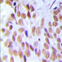 Anti-HMGB1 Antibody