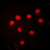 HMGB1 antibody