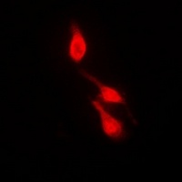 Anti-p38 (Phospho-Y182) Antibody