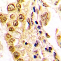 Anti-JUND Antibody