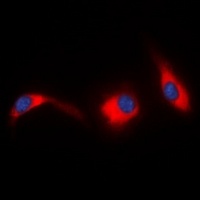 Anti-JNK1/2/3 Antibody