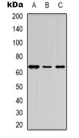 Estrogen Receptor alpha Rabbit Polyclonal Antibody
