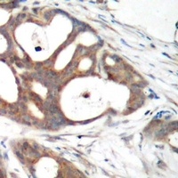 Estrogen Receptor alpha Rabbit Polyclonal Antibody
