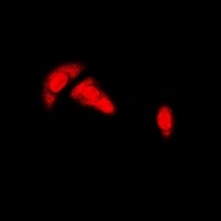 Estrogen Receptor alpha Rabbit Polyclonal Antibody