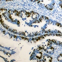 Anti-RB1 (Phospho-S795) Antibody