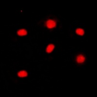 RB1 (phospho-S795) antibody