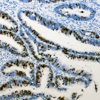Anti-RB1 (Phospho-S807) Antibody