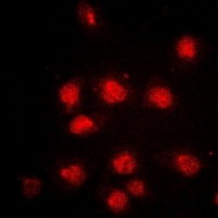 Anti-RB1 (Phospho-S807) Antibody